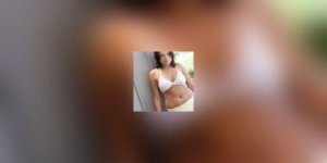 Les dessous de la cellulite