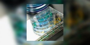 Hepatite C : vers de nouveaux medicaments contre l-infection par le virus de l’hepatite C