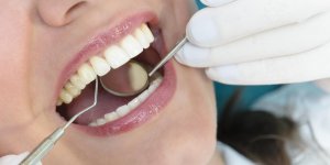 Soins dentaires rembourses a 100% : comment va faire l’Assurance maladie ?