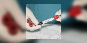 Le sida : premier cas de remission prolongee pour cette jeune Francaise de 18 ans 