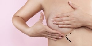 Chirurgie esthetique : 1 femme sur 2 privilegie l’operation des seins
