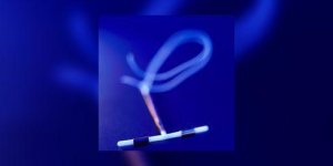 Le sterilet protege du cancer du col de l’uterus