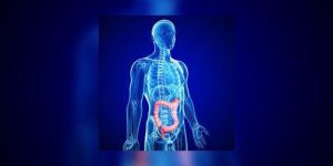 Quand la flore intestinale favorise le cancer du colon …