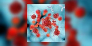Comment faire croire a une cellule cancereuse qu’elle meurt de chaud, et la tuer ?