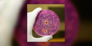 Melanomes : cibler la tumeur, mais aussi les metastases cerebrales