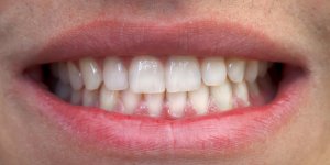 Age, etat de sante : des soins dentaires specifiques