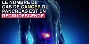 Cancer du pancreas : le diagnostiquer par un prelevement sur la langue