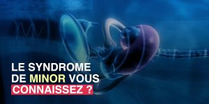 Syndrome de Minor : une femme hypersensible aux bruits de son corps