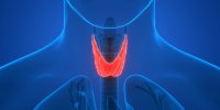 Hyperthyroïdie : définition et symptômes