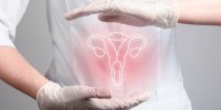 Cancer de l’utérus : un nouveau test non invasif pour les patientes