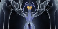 Prostate : les opérations possibles 