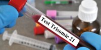 Trisomie 21 : un nouveau dépistage proposé à toutes les femmes enceintes 