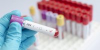 VIH : l’épidémie continue sa hausse en Europe