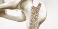 Ostéoporose : 10 aliments qui protègent