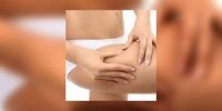 Cellulite
