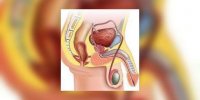 Affections des organes génitaux chez l'homme