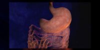 Bande gastrique par laparoscopie
