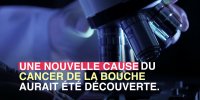 Pollution : les particules fines augmenteraient le risque de cancer de la bouche