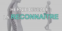 Hernie discale : les signes pour la reconnaître