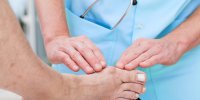 L'oignon de pied, l'hallux valgus expliqué en vidéo