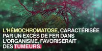 Excès de fer et risque de cancer : un lien ?