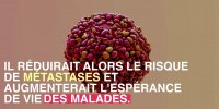 Cancer : un nouveau traitement en spray