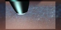 Le micropeeling de la peau en vidéo