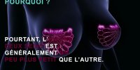 Poitrine féminine : ce qu'il faut savoir