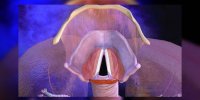 La laryngite expliquée en vidéo