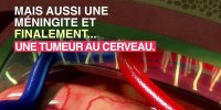Démangeaison des testicules et cancer du cerveau : quel est le lien ?