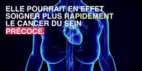 Nice : le cancer du sein précoce soigné en un seul jour