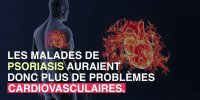 Le psoriasis serait lié à un risque plus élevé de maladies cardiovasculaires
