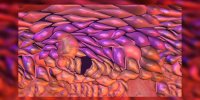 Le cancer de la peau expliqué en vidéo