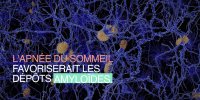 Maladie d'Alzheimer : un lien avec l’apnée du sommeil ?