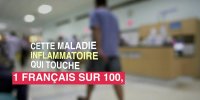 Crise de goutte : un risque d'AVC plus élevé