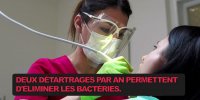Déchaussement dentaire : 5 conseils