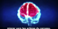 AVC : zoom sur ces signes inquiétants