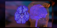 La maladie d'Alzheimer expliquée en vidéo