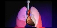 Le cancer du poumon en vidéo