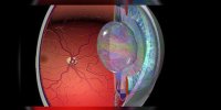 La DMLA ou dégénérescence maculaire expliquée en vidéo