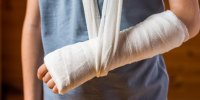 Fractures I