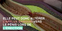 Troubles érectiles : 5 causes possibles
