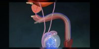 Vasectomie
