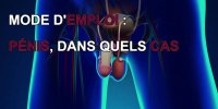 Pénis : 4 problèmes génitaux