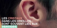 Vertiges : les cristaux dans les oreilles, c'est quoi ?