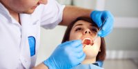 Les caries dentaires expliquées en vidéo