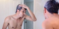 L'alopécie expliquée en vidéo