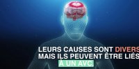 Vertiges : quand faut-il s'inquiéter ?
