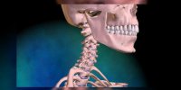 Traumatisme cranio-cervical
