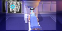Radiochirurgie robotisée Cyberknife®